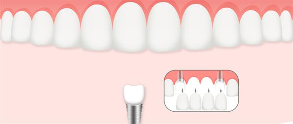 濟(jì)南口腔醫(yī)學(xué)專業(yè)學(xué)校是什么層次的學(xué)校？學(xué)校怎么樣？