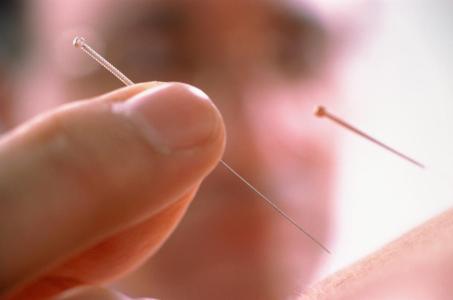 石家莊炎黃針灸推拿學(xué)校：針灸推拿有哪些好處？